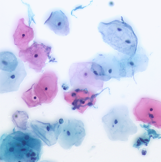 BLM5-241 LCD Digital Biological Microscope