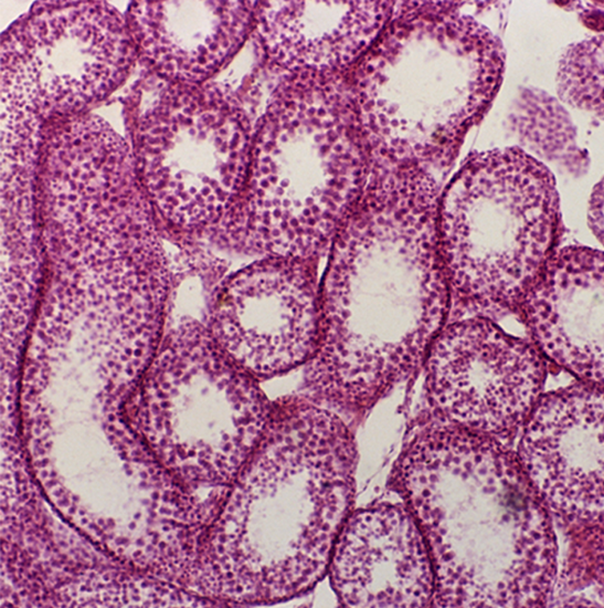 BLM4-220 LCD Digital Biological Microscope