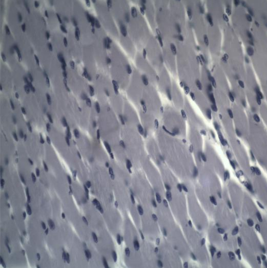 BLM4-230 LCD Digital Biological Microscope