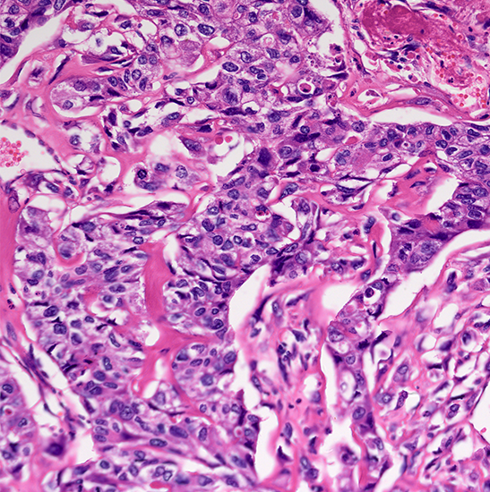 BLM5-241 LCD Digital Biological Microscope