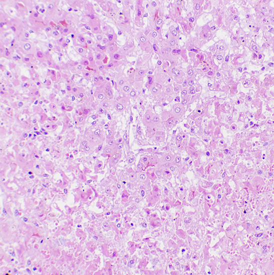 BLM5-243 LCD Digital Biological Microscope
