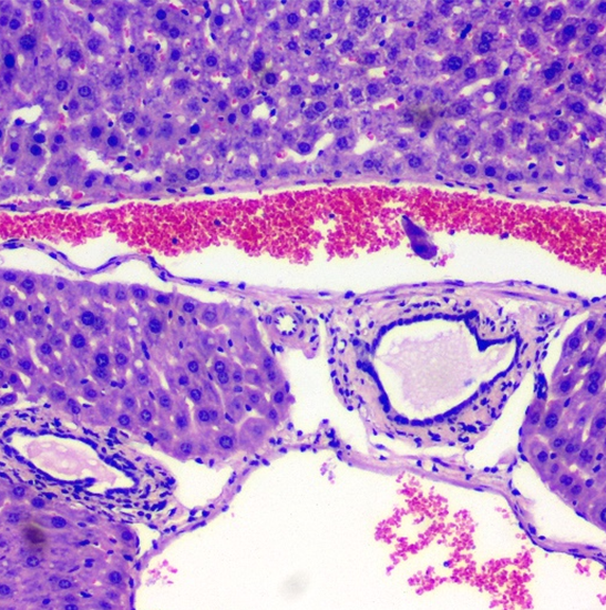 BLM4-221 LCD Digital Biological Microscope