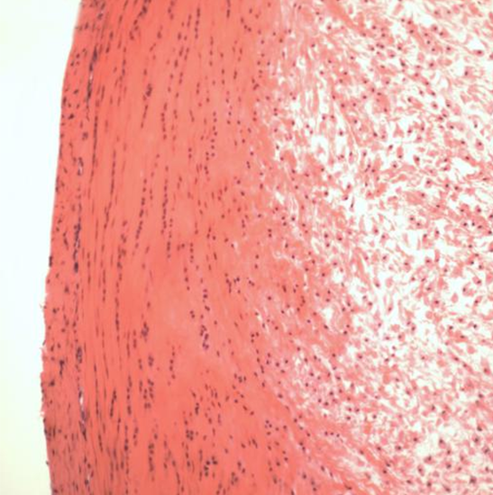 BLM4-230 LCD Digital Biological Microscope