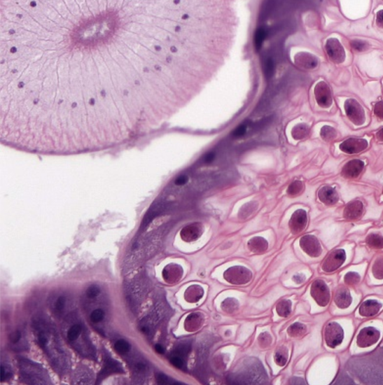 BLM5-227 LCD Digital Biological Microscope