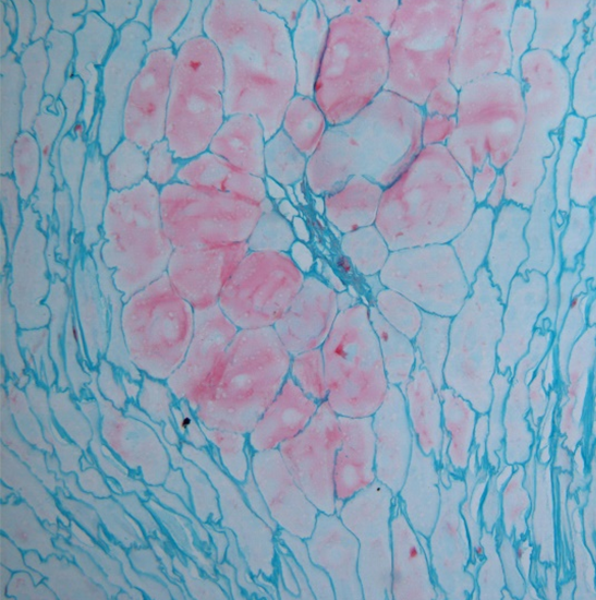 BLM5-252 LCD Digital Biological Microscope