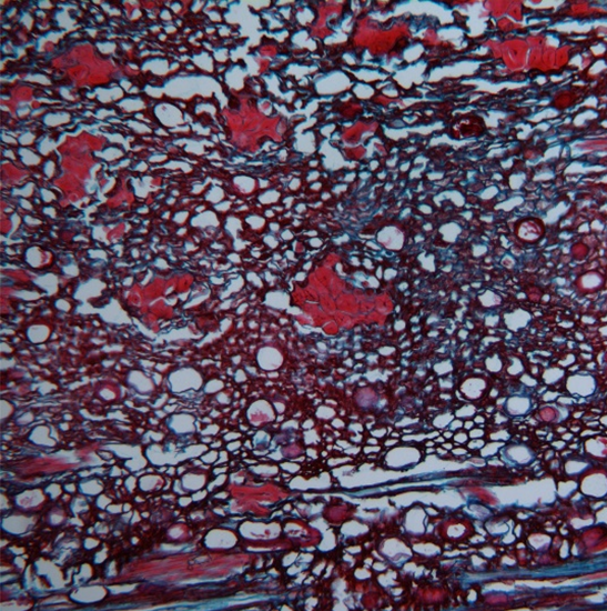 BLM5-252 LCD Digital Biological Microscope
