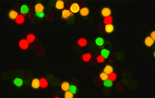 Scientific Microscope Camera Buying Guide: Resolution, Sensitivity and Frame Rate