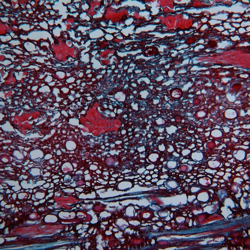 BS-2052B(Plan) Binocular Biological Microscope