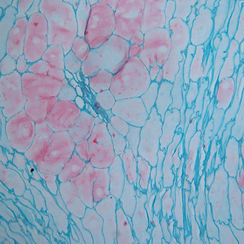 BS-2052B(Plan) Binocular Biological Microscope
