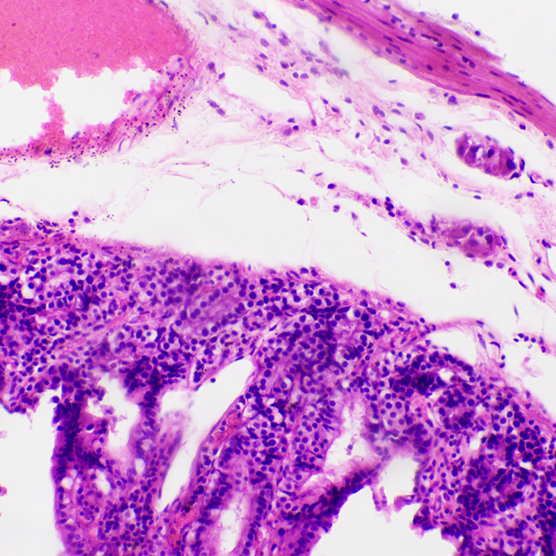 BS-2029B Binocular Biological Microscope